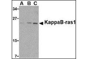 Image no. 2 for anti-NFKB Inhibitor Interacting Ras-Like 1 (NKIRAS1) (C-Term) antibody (ABIN500112)