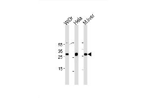 Image no. 1 for anti-Caudal Type Homeobox 1 (CDX1) antibody (ABIN1882223)