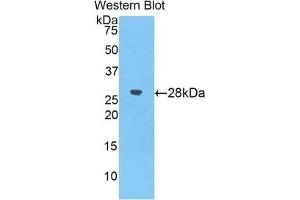 Image no. 2 for alpha-2-Macroglobulin (A2M) ELISA Kit (ABIN6574099)