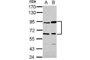 Image no. 3 for anti-Complement Factor B (CFB) (Internal Region) antibody (ABIN2855659)