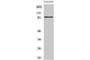 Image no. 1 for anti-Tousled-Like Kinase 2 (TLK2) (Internal Region) antibody (ABIN3187284)