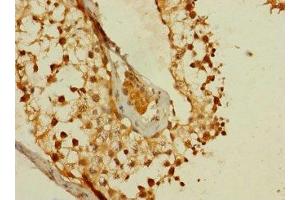 Immunohistochemistry of paraffin-embedded human testis tissue using ABIN7159403 at dilution of 1:100