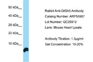 anti-General Transcription Factor IIH, Polypeptide 5 (GTF2H5) (N-Term) antibody