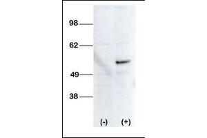 Image no. 2 for anti-serine/threonine Kinase 38 Like (STK38L) (AA 408-437), (C-Term) antibody (ABIN392120)