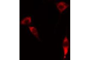 Image no. 3 for anti-Forkhead Box C1 (FOXC1) antibody (ABIN6256860)