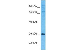 Image no. 1 for anti-Exosome Component 5 (EXOSC5) (N-Term) antibody (ABIN5672011)