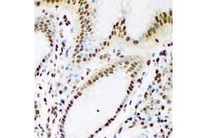 Image no. 2 for anti-TAR DNA Binding Protein (TARDBP) (full length) antibody (ABIN6006162)