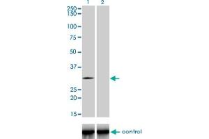 Image no. 2 for anti-T-Cell Leukemia Homeobox 3 (TLX3) (AA 192-291) antibody (ABIN565459)