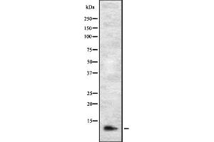 Image no. 1 for anti-Disrupted in Renal Carcinoma 1 (DIRC1) antibody (ABIN6259584)