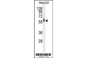 Image no. 2 for anti-Glypican 3 (GPC3) (AA 21-50), (N-Term) antibody (ABIN390317)