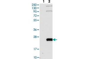 Image no. 2 for anti-WW Domain Binding Protein 5 (WBP5) antibody (ABIN5590868)