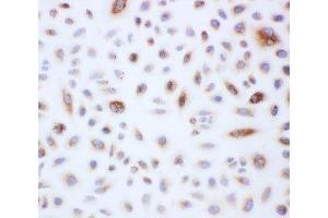 Peroxiredoxin 3 antibody and A549 cells tested by ICC