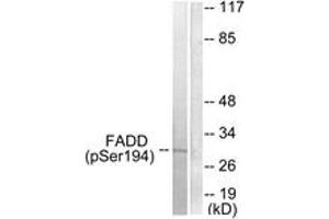 Western blot analysis of extracts from HeLa cells treated with Paclitaxel 1uM 60', using FADD (Phospho-Ser194) Antibody.