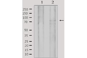 Image no. 2 for anti-MYST Histone Acetyltransferase 2 (MYST2) (Internal Region) antibody (ABIN6257254)