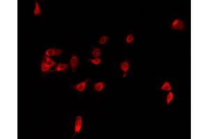 Image no. 4 for anti-Iroquois Homeobox Protein 2 (IRX2) antibody (ABIN6262670)