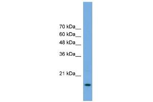 Image no. 1 for anti-Processing of Precursor 5, Ribonuclease P/MRP Subunit (POP5) (Middle Region) antibody (ABIN2786894)