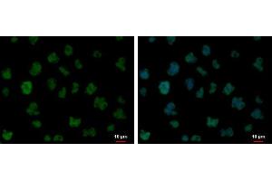 Image no. 6 for anti-Far Upstream Element (FUSE) Binding Protein 1 (FUBP1) (Center) antibody (ABIN2855856)