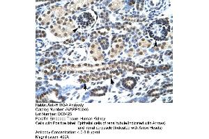 Image no. 2 for anti-Serotonin Receptor 3A (HTR3A) (N-Term) antibody (ABIN2792275)
