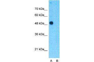 Image no. 3 for anti-TEA Domain Family Member 4 (TEAD4) (C-Term) antibody (ABIN2780491)