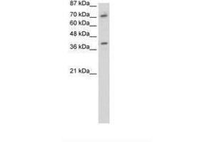 Image no. 1 for anti-Zinc Finger Protein 282 (ZNF282) (C-Term) antibody (ABIN202865)
