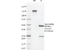 Image no. 1 for anti-CD1a (CD1a) antibody (ABIN6940996)