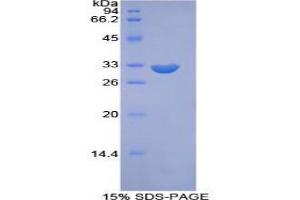 Image no. 1 for phosphoinositide Kinase, FYVE Finger Containing (PIKFYVE) protein (ABIN3011153)