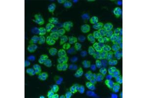 Image no. 2 for anti-Cathelicidin Antimicrobial Peptide (CAMP) antibody (ABIN350186)