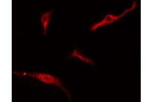 Image no. 2 for anti-Ribosomal Protein L10a (RPL10A) antibody (ABIN6257631)