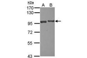 Image no. 1 for anti-USP6 N-terminal Like (USP6NL) (N-Term) antibody (ABIN1494111)