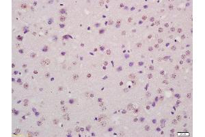 Image no. 2 for anti-Tumor Protein P73 (TP73) (AA 501-631) antibody (ABIN675279)