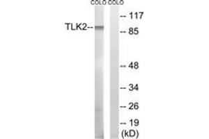 Image no. 1 for anti-Tousled-Like Kinase 2 (TLK2) (AA 191-240) antibody (ABIN1535347)