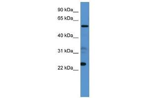 Image no. 1 for anti-Copine IX (CPNE9) (C-Term) antibody (ABIN928677)