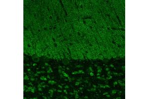 Image no. 1 for anti-SH3 and Multiple Ankyrin Repeat Domains 3 (SHANK3) (AA 1055-1616) antibody (ABIN1742347)