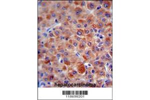 Image no. 2 for anti-Complement Factor H (CFH) (AA 751-780) antibody (ABIN654896)