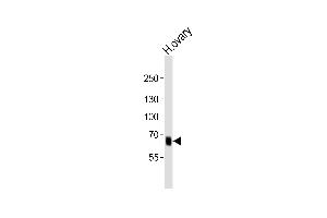 Western blot analysis of lysate from human ovary tissue lysate, using PRDM13 Antibody (N-term) (ABIN6242532 and ABIN6577576).