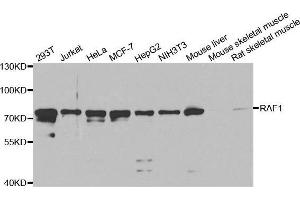 Image no. 1 for anti-V-Raf-1 Murine Leukemia Viral Oncogene Homolog 1 (RAF1) (C-Term) antibody (ABIN3020713)