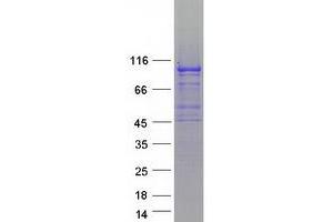 Image no. 1 for Schlafen Family Member 5 (SLFN5) protein (Myc-DYKDDDDK Tag) (ABIN2732191)