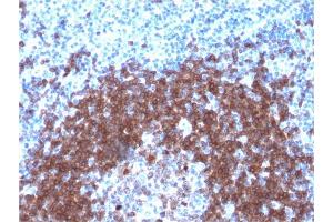 Image no. 4 for anti-B-cell antigen receptor complex-associated protein alpha chain (CD79A) (AA 202-216) antibody (ABIN6941270)
