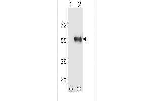 ALDH3B1 antibody  (AA 334-360)