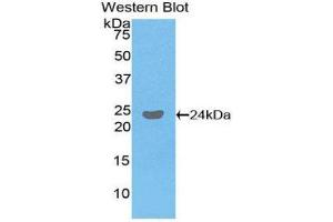 Image no. 1 for anti-Fc Fragment of IgG, Low Affinity IIIb, Receptor (CD16b) (FCGR3B) (AA 24-203) antibody (ABIN1858834)