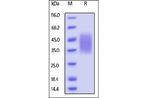 Image no. 2 for CD47 (CD47) (AA 19-141) (Active) protein (His tag) (ABIN5674615)