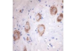 Image no. 3 for anti-Solute Carrier Family 18 (Vesicular Acetylcholine), Member 3 (SLC18A3) (Internal Region) antibody (ABIN571639)