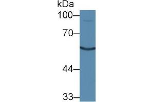 Calcitonin Receptor Antikörper  (AA 42-170)
