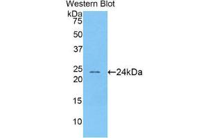 Image no. 1 for anti-Acetylcholinesterase (AChE) (AA 123-334) antibody (ABIN1174625)