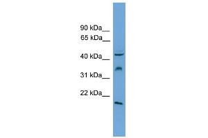 Image no. 2 for anti-Dual Specificity Phosphatase 5 (DUSP5) (Middle Region) antibody (ABIN2787599)