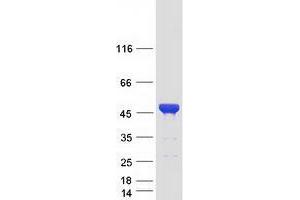 Image no. 1 for Centrosomal Protein 41kDa (CEP41) protein (Myc-DYKDDDDK Tag) (ABIN2734444)