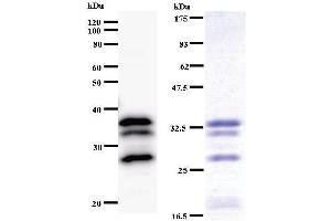 Image no. 1 for anti-Valyl-tRNA Synthetase (VARS) antibody (ABIN930960)
