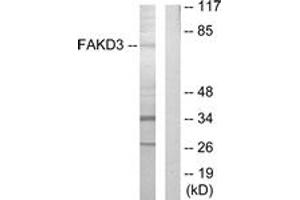 Image no. 1 for anti-FAST Kinase Domains 3 (FASTKD3) (AA 121-170) antibody (ABIN1533897)