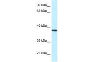Image no. 1 for anti-Proline-serine-threonine Phosphatase Interacting Protein 2 (PSTPIP2) (AA 122-171) antibody (ABIN6747506)
