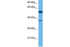 Image no. 5 for anti-Prolyl 4-Hydroxylase, beta Polypeptide (P4HB) (N-Term) antibody (ABIN2783245)